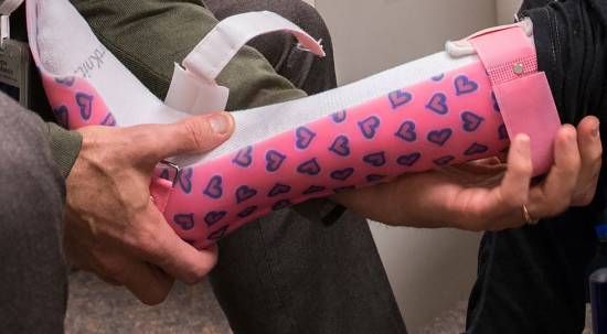 patterned pink ankle foot orthosis during fitting at Gillette Children's Specialty Healthcare