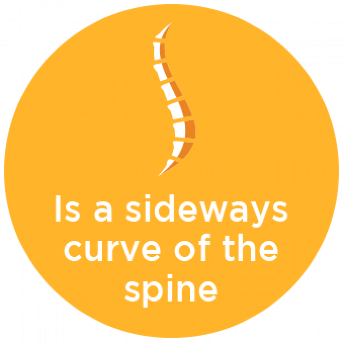 Scoliosis is a Sideways Curve of the Spine