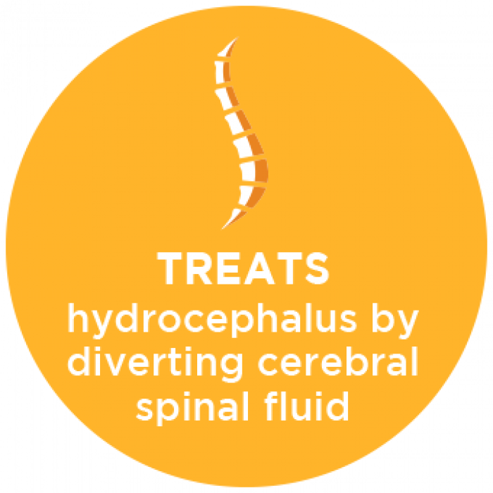 Treats Hydrocephalus By Diverting Spinal Fluid