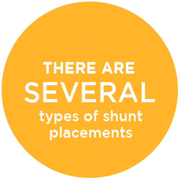 There are Several Types of Shunts