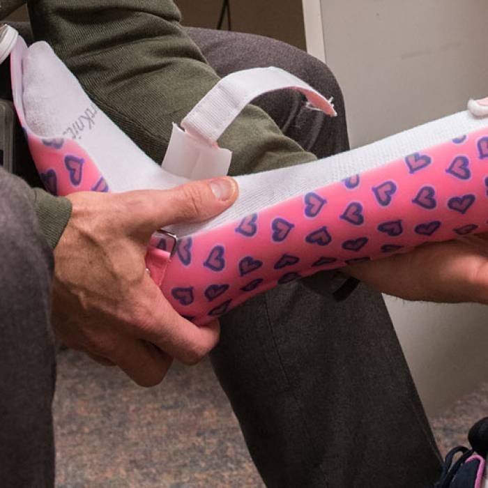 Ankle foot orthoses with pink pattern during fitting at Gillette children's specialty healthcare