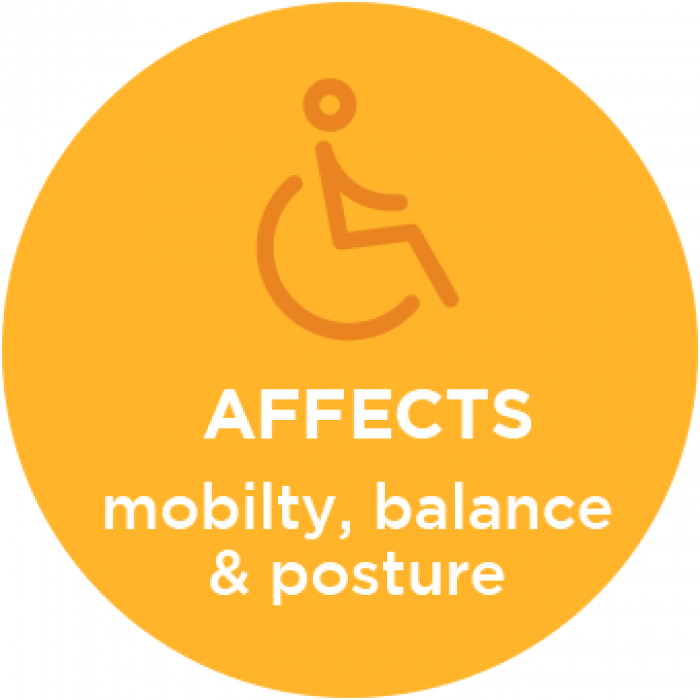 Cerebral Palsy Affects Mobility, Balance and Posture