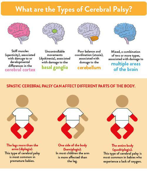 infographic - what are the types of cerebral palsy?